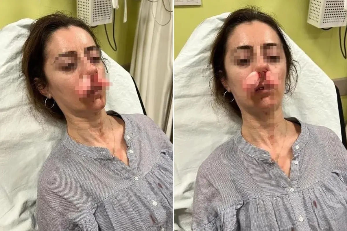 Kocasının sevgilisi zannedip öldüresiye darp etmişti! Arabanın kapısı silah sayıldı