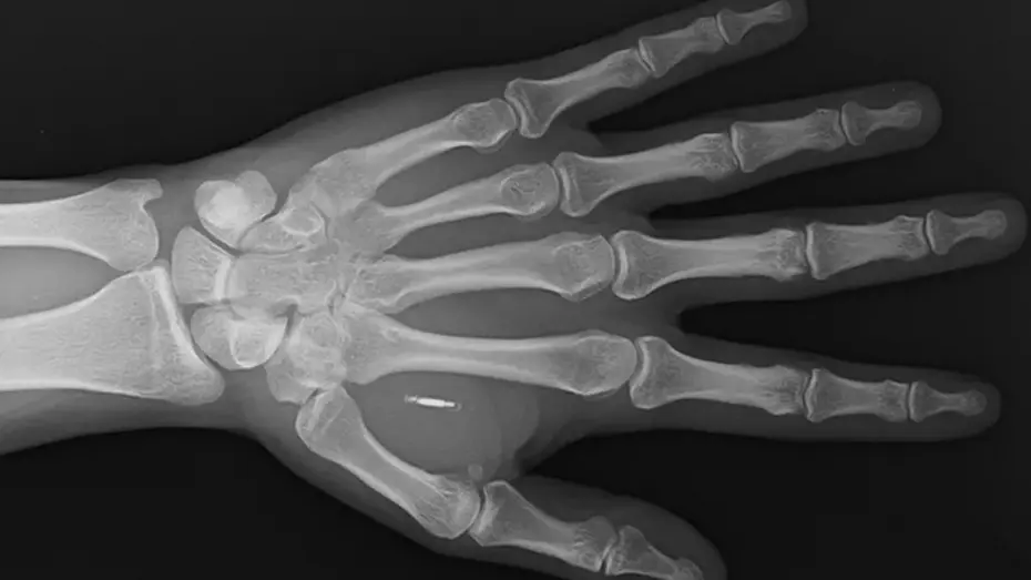 Mikroçip İmplantının Şifresini Unutan Sihirbazın Hikayesi